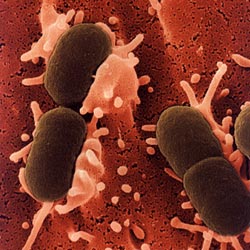 Sản phụ dễ tử vong do nhiễm E. coli