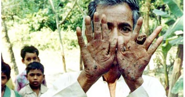 Đông Nam Á có tỉ lệ nhiễm độc asen trong nước cao