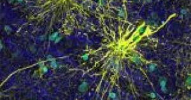 Điều gì khiến con người khác với loài chuột?