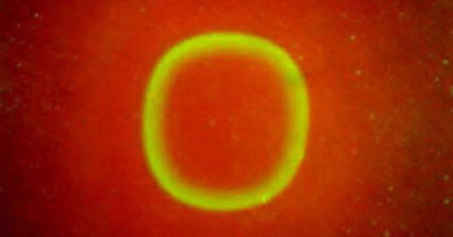 Vi khuẩn hình thành dạng sóng khi có tác động của oxy