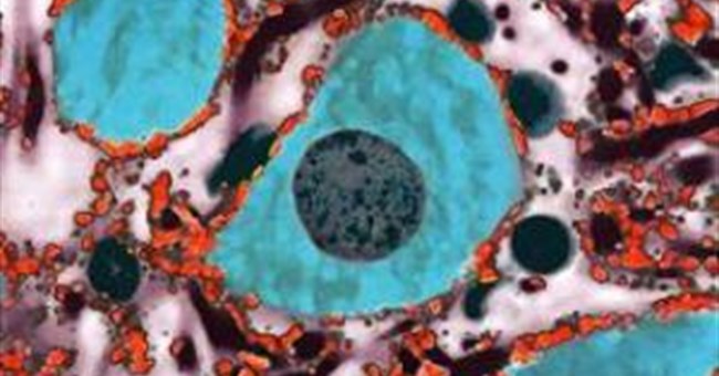 Màu thực phẩm có thể giảm tổn thương tủy sống