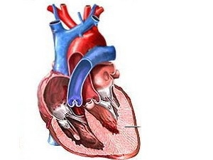 Phát hiện nhiều loại biến thể gen gây bệnh tim
