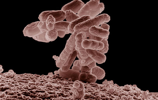 Vi khuẩn hàn kín bê tông