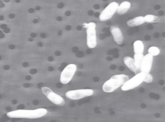 Vi khuẩn có thể sống trong môi trường thạch tín