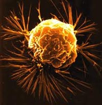 Tế bào phát sinh vụ nổ lớn gây "ung thư bất ngờ"