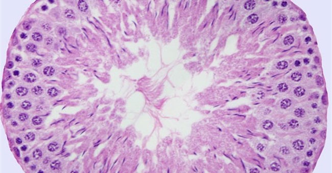 Tránh thai cho nam giới bằng sóng siêu âm