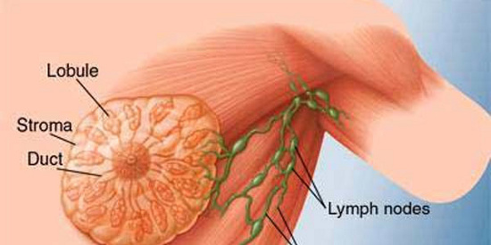 Phát hiện nhân tố biến đổi gene điều trị ung thư vú