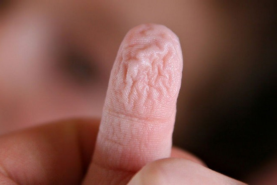 Vì sao ngón tay nhăn nheo khi ngâm nước?