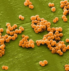 Cách kháng thuốc của siêu vi khuẩn