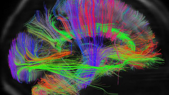 Một hình ảnh 3D trong dự án bản đồ não người