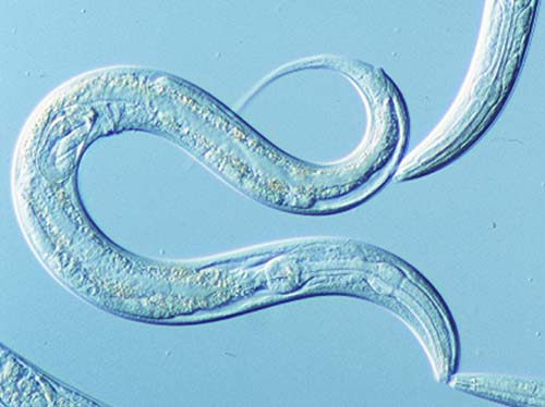Giun tròn C. elegans giúp giảm bệnh béo phì ở người