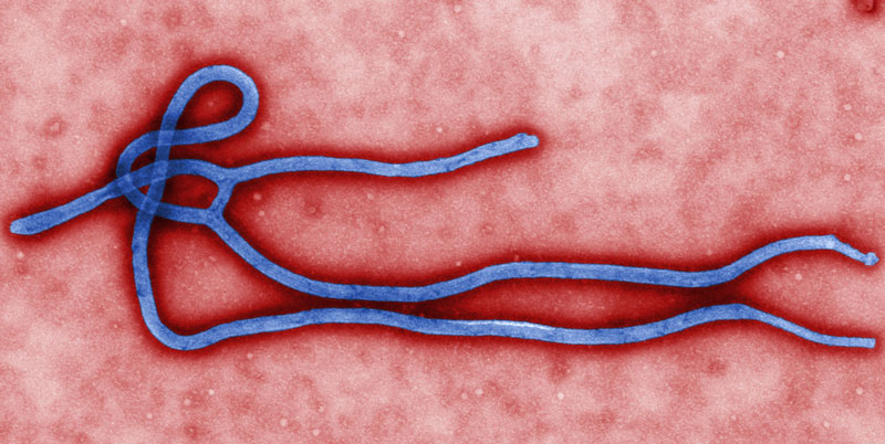 Thuốc chữa ung thư có thể ngăn chặn virus Ebola