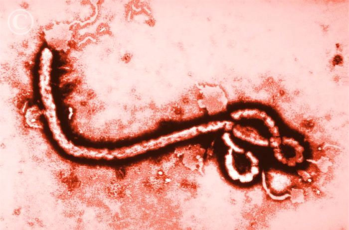 Thuốc chữa ung thư có thể ngăn chặn virus Ebola