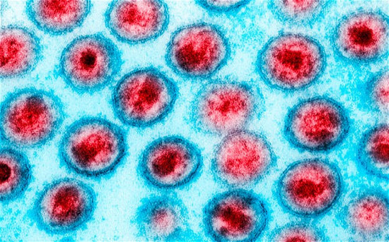 Virus HIV có thể bị tiêu diệt hoàn toàn bằng những loại thuốc hiện có.