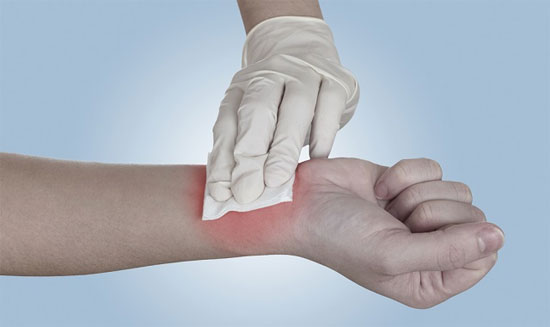 Băng gạc cứu thương có thể biến mất nếu Veti-Gel được sử dụng rộng rãi. 