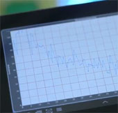 Video: Chip hỗ trợ smartphone dự đoán cơn đau tim