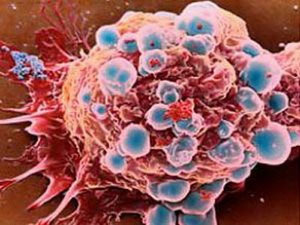Phát hiện chất gây lão hóa trong tế bào ung thư
