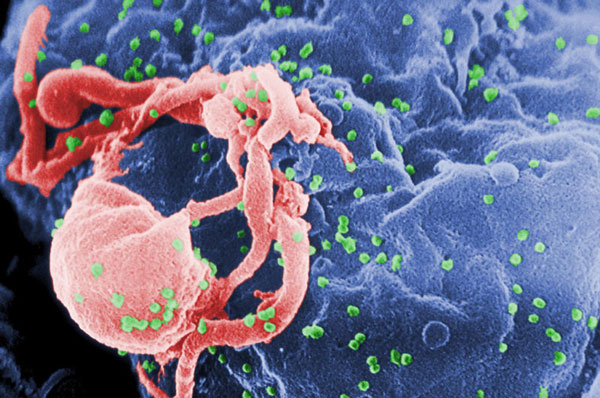 Tạo ra tế bào có thể tiêu diệt virút HIV