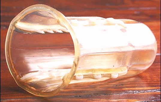 Những loại 