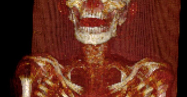 Căn bệnh kinh khủng trên xác ướp Ai Cập cổ đại