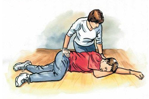 Khi có dấu hiệu của cơn thiếu máu não thoáng qua, cần đặt bệnh nhân  nằm nghiêng như tư thế người trong hình minh họa và gọi cấp cứu.