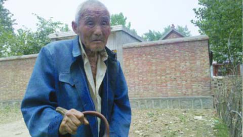 Kỳ lạ ông lão mọc sừng trên tay