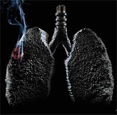 Hình ảnh về sự tàn phá khủng khiếp của thuốc lá