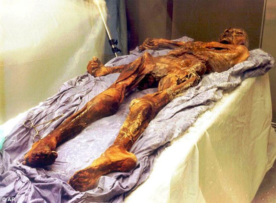 Nguyên nhân mới về cái chết của người băng Otzi