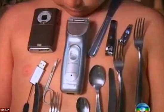 Video cậu bé hút kim loại bằng cơ thể