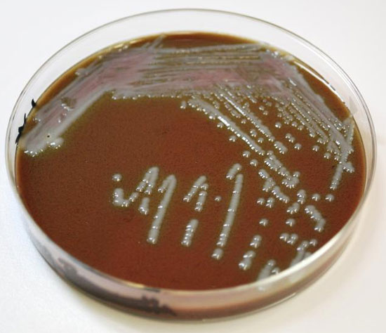 Vi khuẩn gây độc vượt qua hệ thống phòng thủ cơ thể như thế nào?