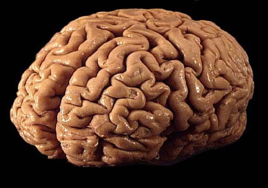 Não của thiên tài và kẻ đần độn giống nhau 95% 