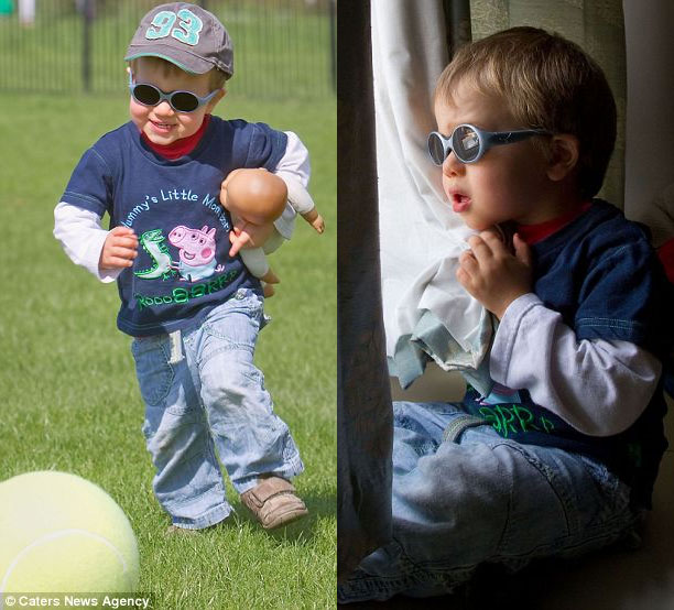 Bệnh Achromatopsia khiến cậu bé Harvey luôn phải đeo loại kính râm đặc biệt chỉ cho 10% ánh sáng lọt qua mọi lúc, mọi nơi, trừ khi ngủ. 