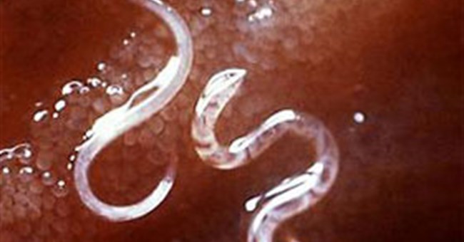 Uống 2.500 trứng giun ký sinh để trị bệnh 