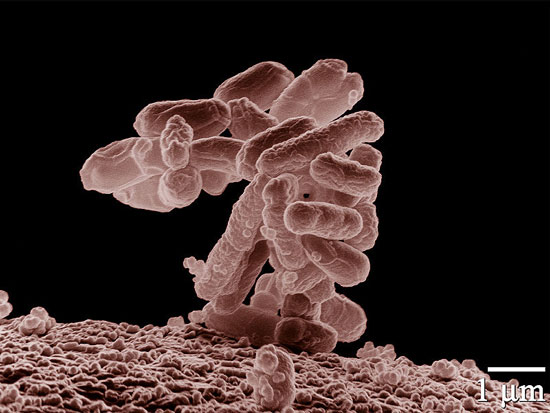 “Tái thiết kế” khuẩn E.coli để chống trực khuẩn mủ xanh