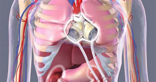 Tạo tim người từ tế bào gốc