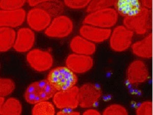 Các tế bào máu màu đỏ bị nhiễm ký sinh trùng gây bệnh sốt rét.
