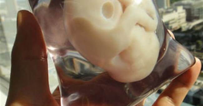 Mô hình 3D của bào thai