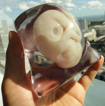 Mô hình 3D của bào thai