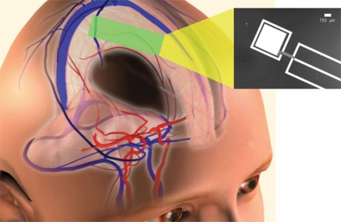 Bước đầu nghiên cứu được phương pháp lấy điện từ não người