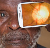 Video: Ứng dụng giúp giảm nguy cơ mù loà
