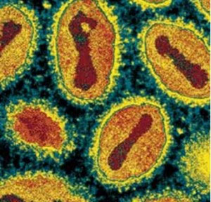Virút bệnh đậu mùa có thể tiêu diệt tế bào ung thư