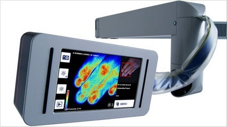 Thiết bị có tên “Hình ảnh Laser Doppler” có khả năng hiển thị lượng máu lưu thông trong da của những bệnh nhân bị bỏng (Ảnh: BBC)