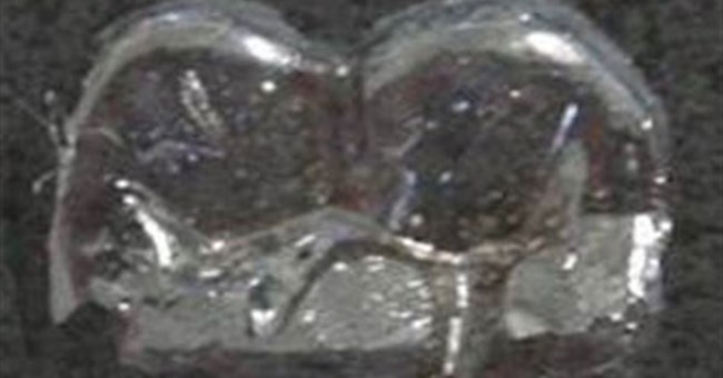 Nhật tạo ra miếng vá chống sâu răng vĩnh viễn