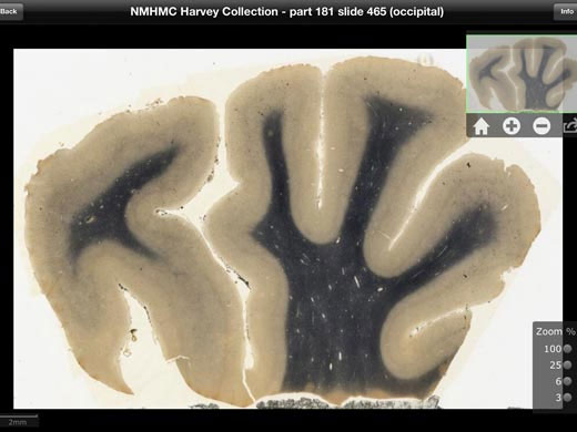 Tải hình ảnh bộ não của Einstein