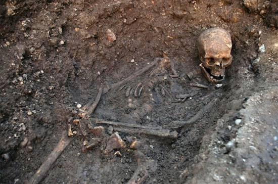 Chẩn bệnh cho vua Richard III
