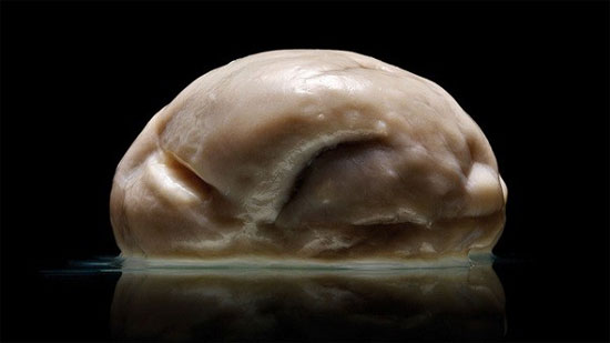Hình ảnh bộ não người 