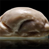 Hình ảnh bộ não người "phẳng" đến kỳ lạ mới được công bố
