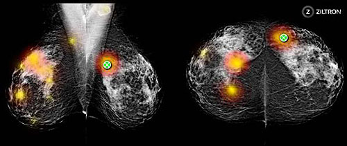 Ảnh chụp màn hình của bản đồ nhiệt