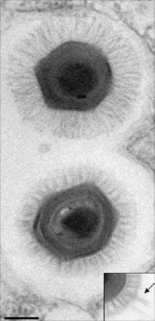 Những sợi siêu nhỏ bên ngoài lớp vỏ của siêu virus hiện ra dưới kính hiển vi. (Ảnh: BBC)