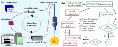 Công nghệ SMART - Bước tiến lớn trong phẫu thuật y học